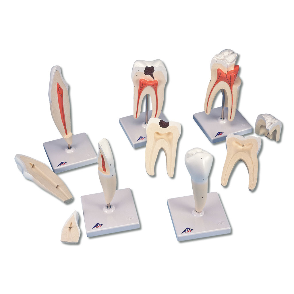 Zahnmodelle - Set mit 5 Stück