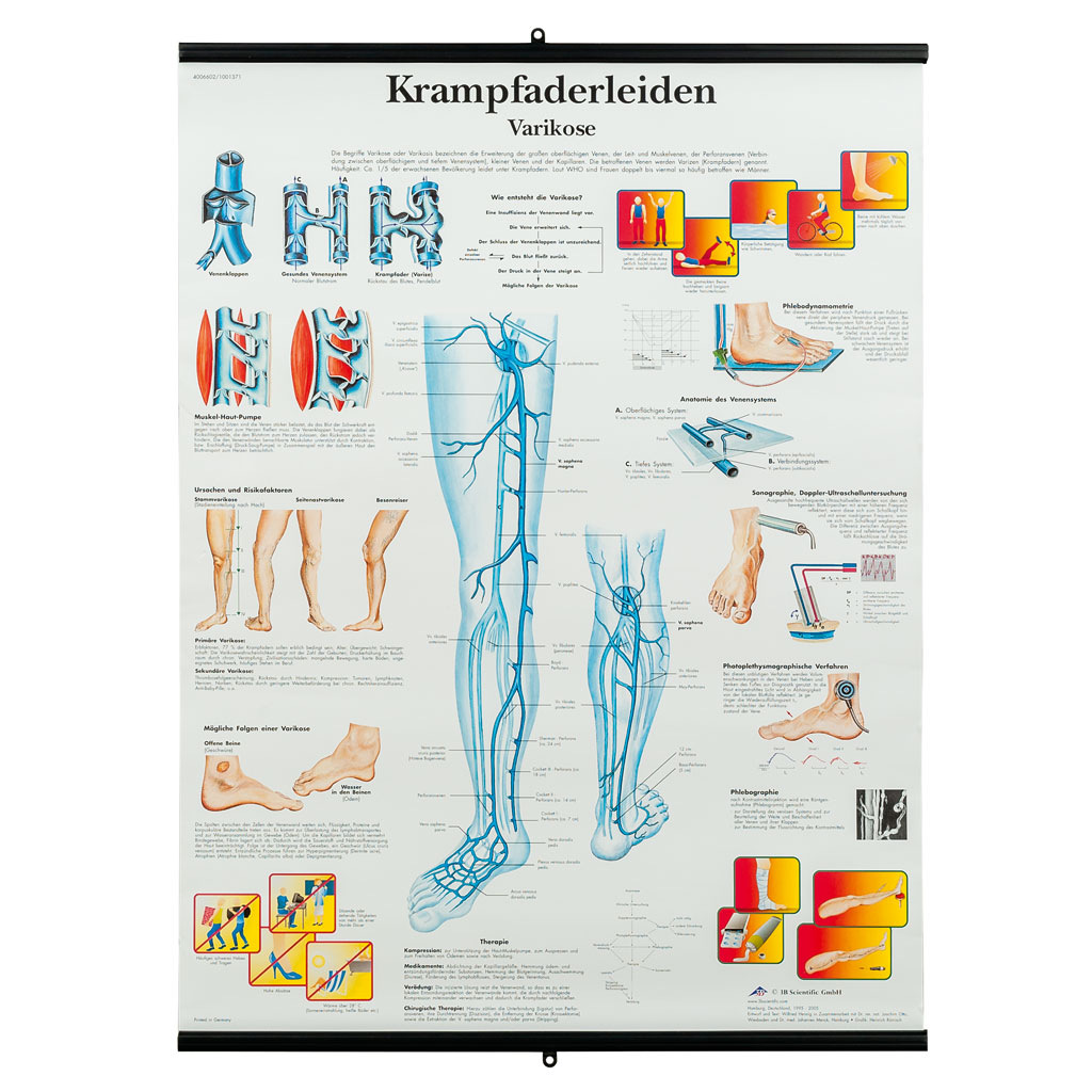 Krampfaderleiden, Varikose - Poster