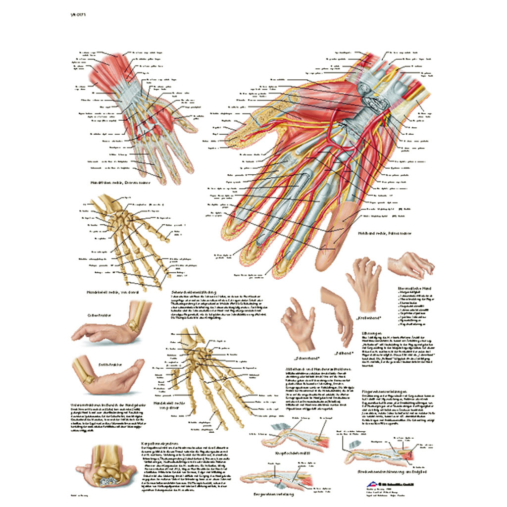 Hand und Handgelenk - Anatomie und Pathologie - Poster laminiert