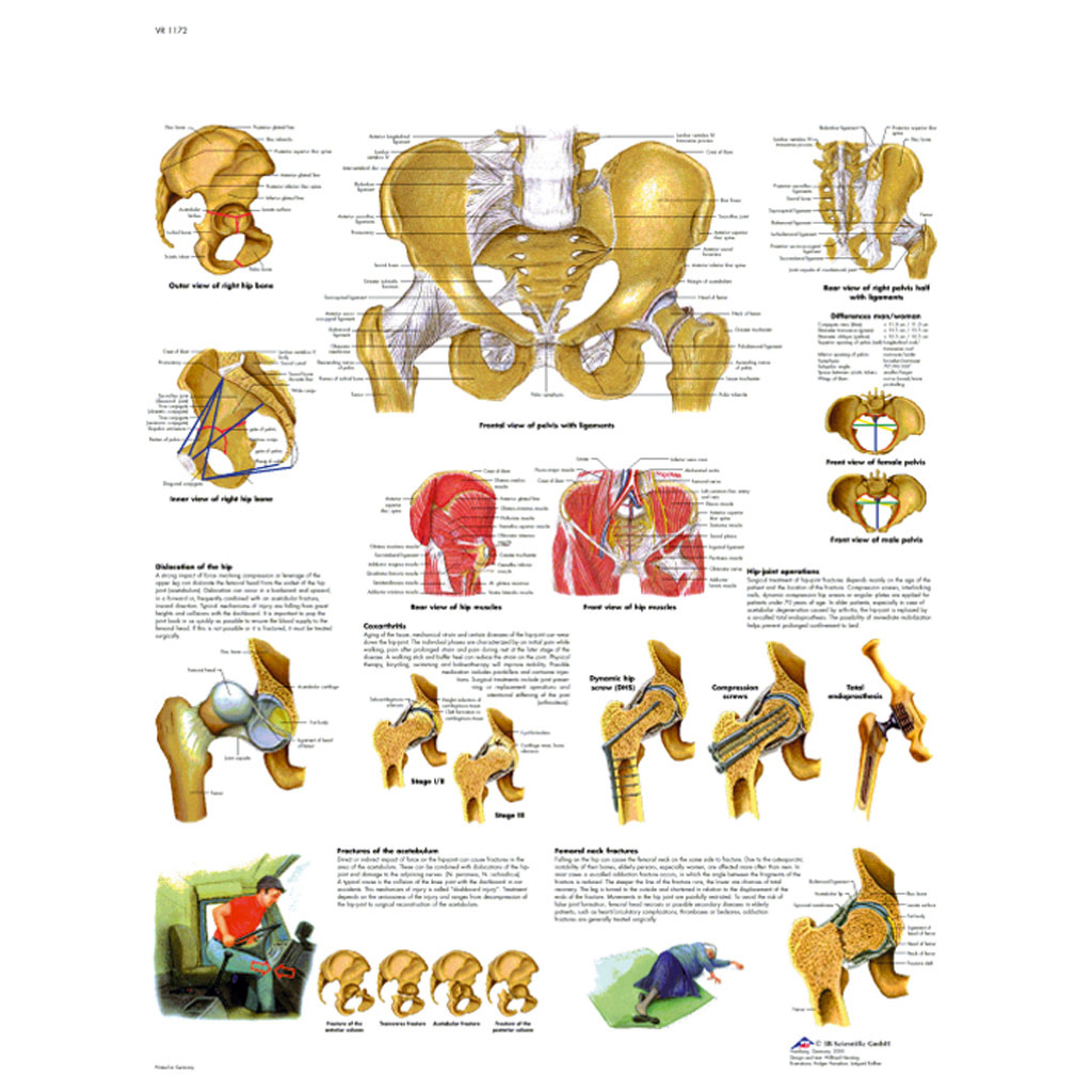 Becken und Hüfte - Anatomie und Pathologie - Poster laminiert